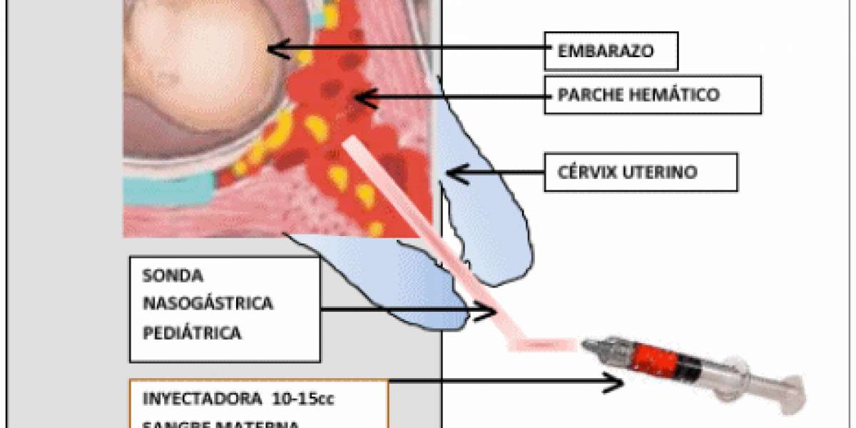 Keygen IZo Pe Oy 2 V2.0.3 Incl Emula License Free Zip Torrent Final