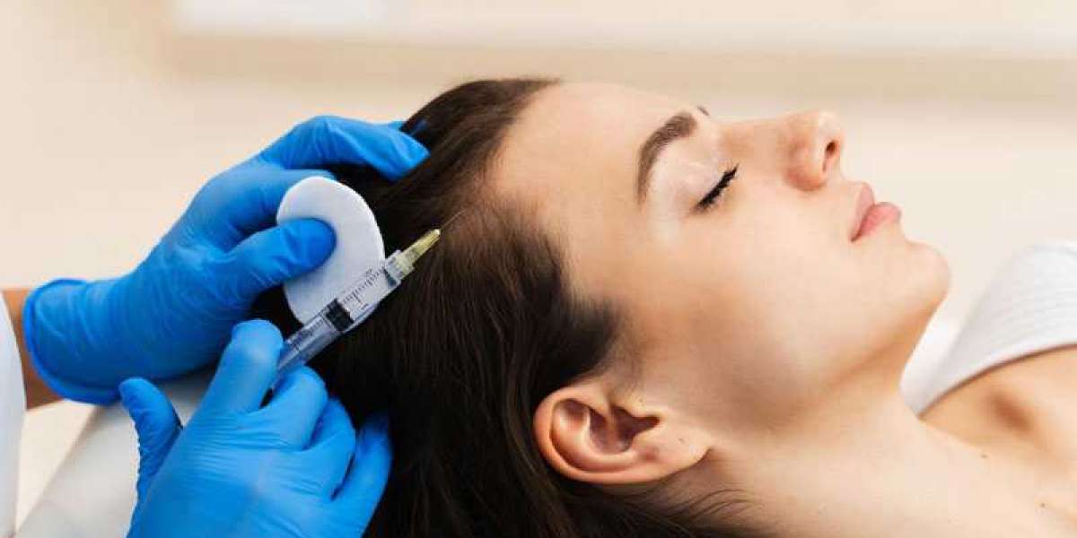 Is PRP Hair Treatment the Best Non-Surgical Solution for Hair Loss?