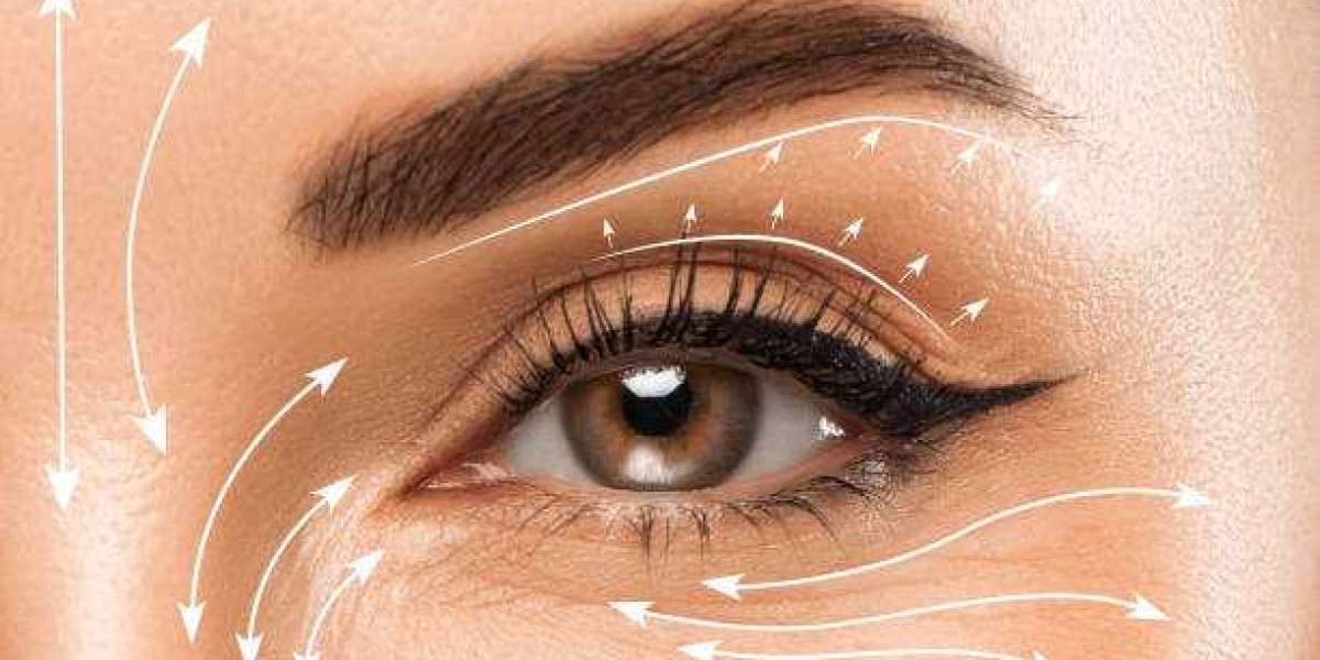 Does Eyelid Surgery Fix Droopy Eyelids Naturally?