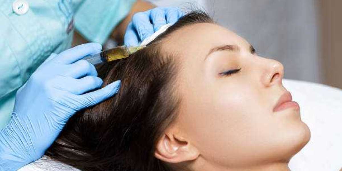 How PRP Therapy Revitalizes Hair Naturally in Riyadh