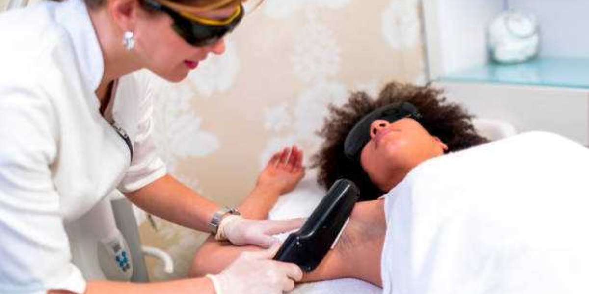 Does Laser Hair Removal Hurt During Treatment?