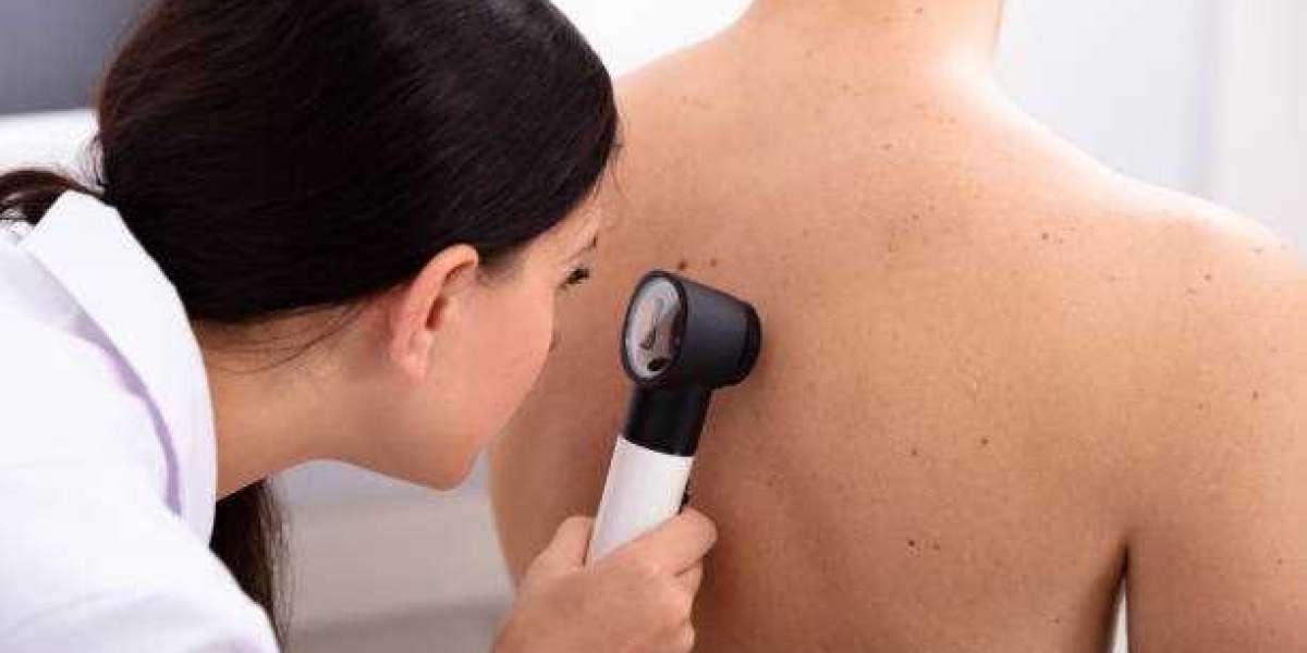 Expert Tips: How to Treat Back Acne and Neutralize Its Harmful Effects