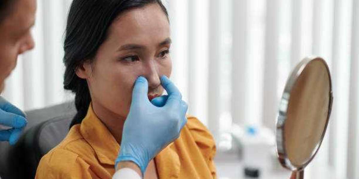 Best rhinoplasty surgeon advice for safe transformation