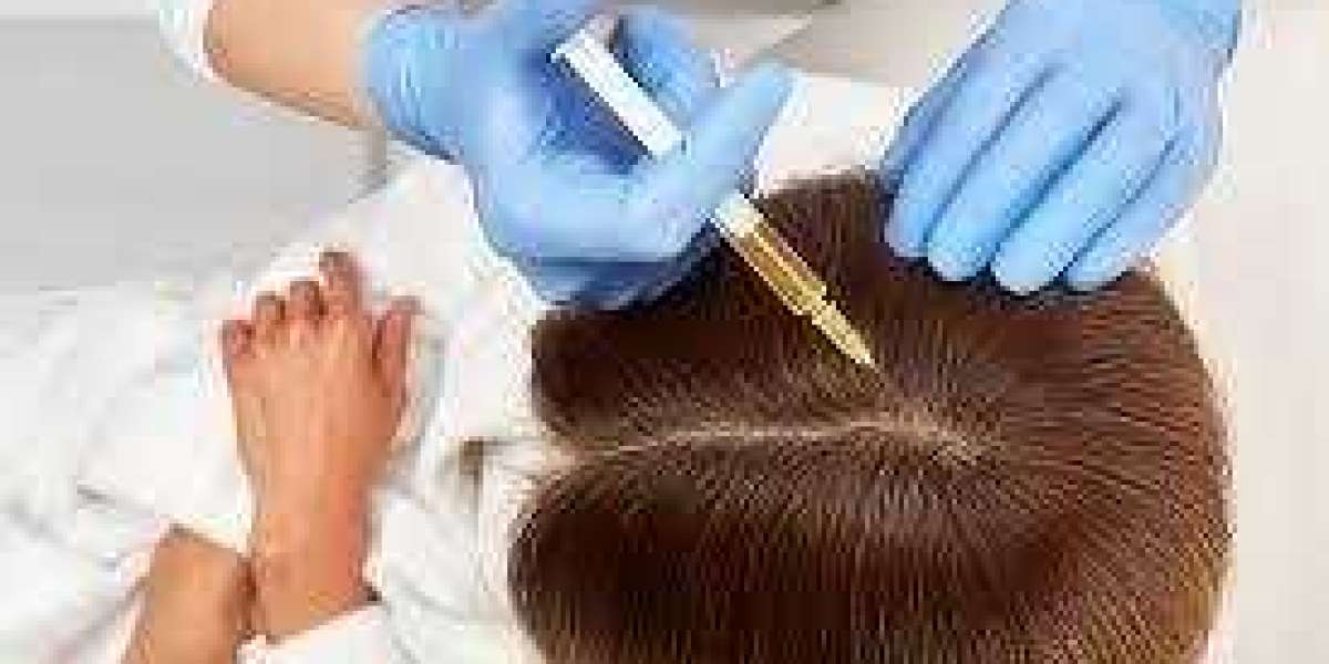 Can PRP Help Reduce Hair Shedding?