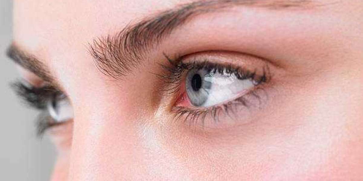 How Do Fat Repositioning Methods Smooth Lids?