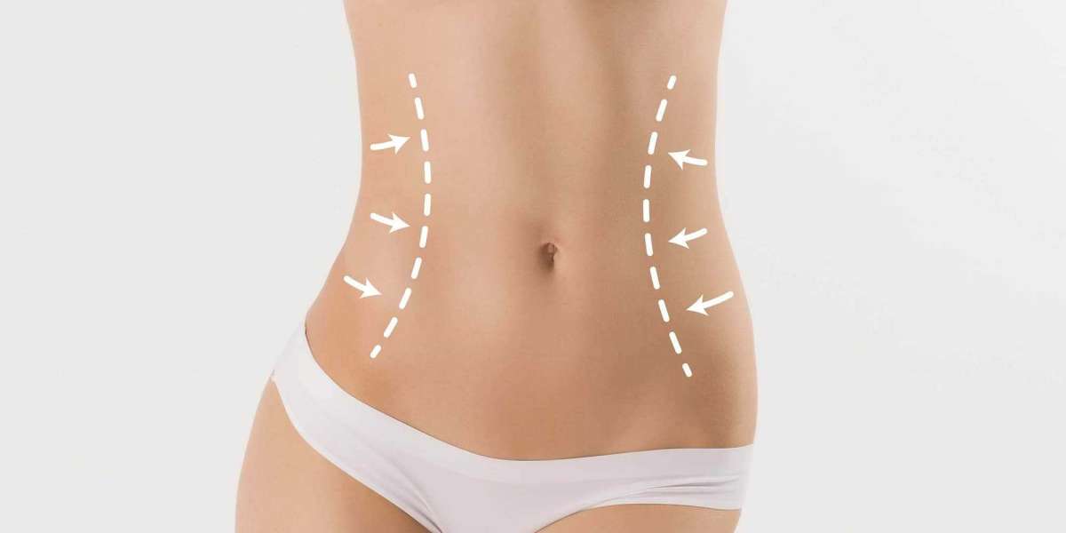 Who is the Ideal Candidate for Body Contouring in Islamabad
