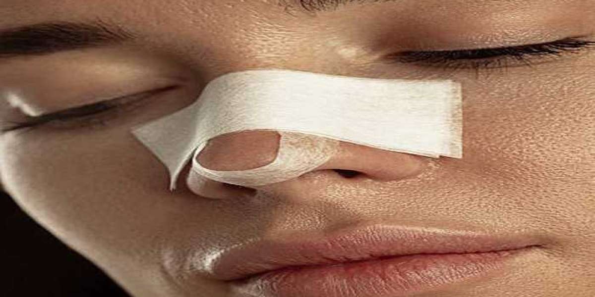 How Rhinoplasty Can Improve Facial Harmony in Riyadh
