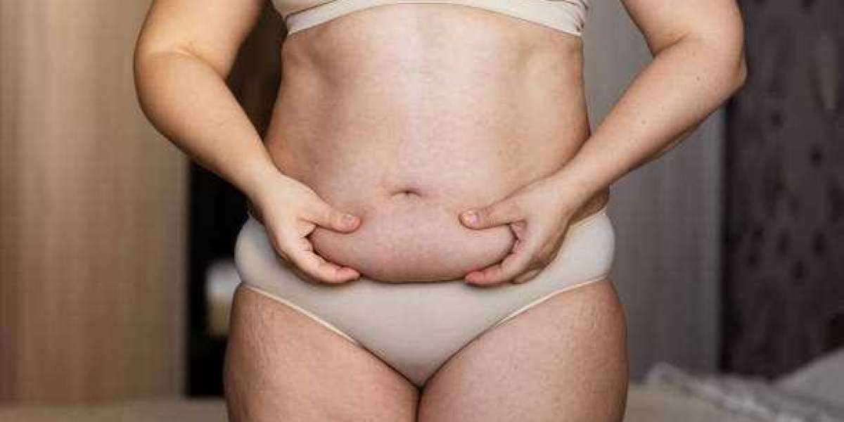 Tummy Tuck Photography Tips for Tracking Healing Progress