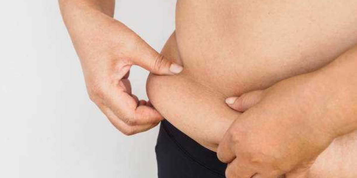 Exploring Tummy Tuck Options in Riyadh for Body Contouring