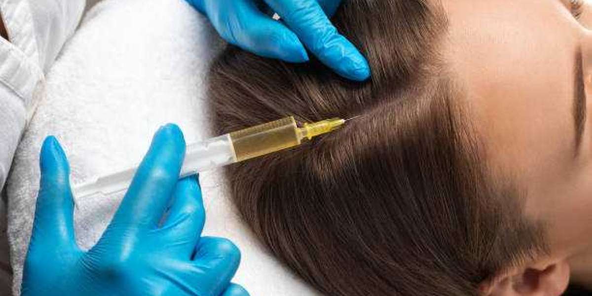 How Mesotherapy Treatment Supports Healthy Hair Restoration