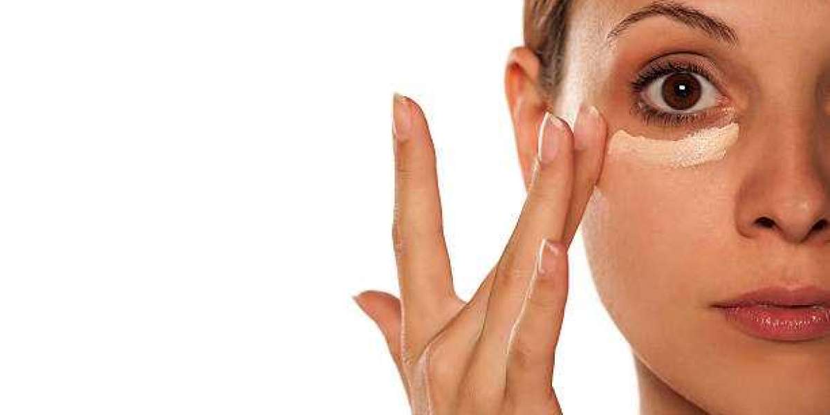 Dark Circles Treatment Guide for a More Refreshed Appearance