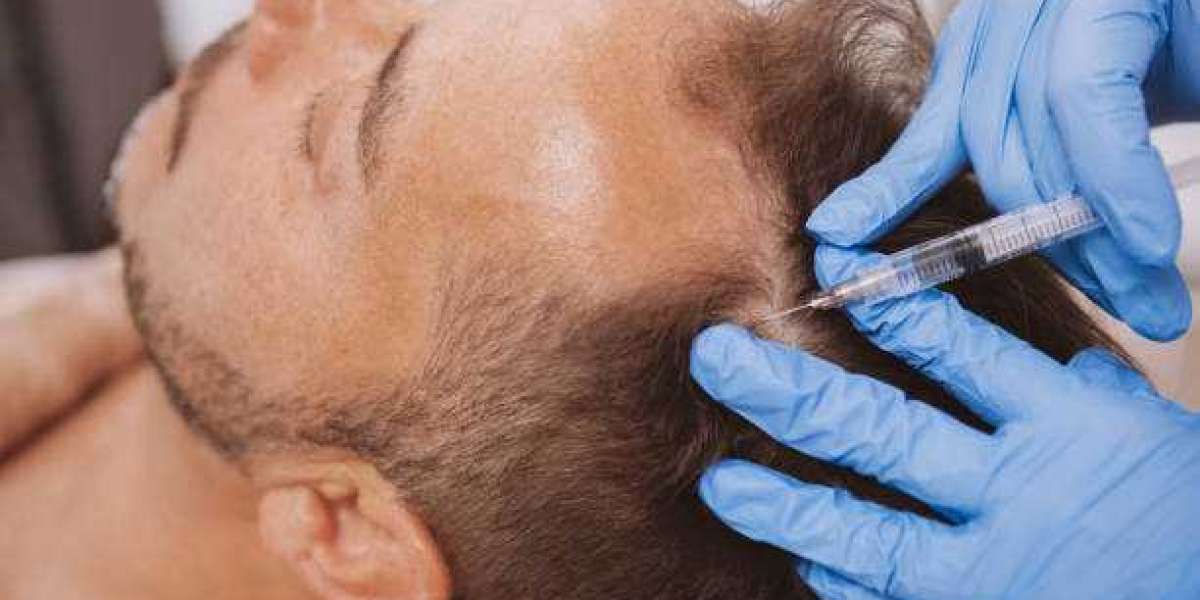PRP Hair Treatment for Hair Strength and Scalp Wellness