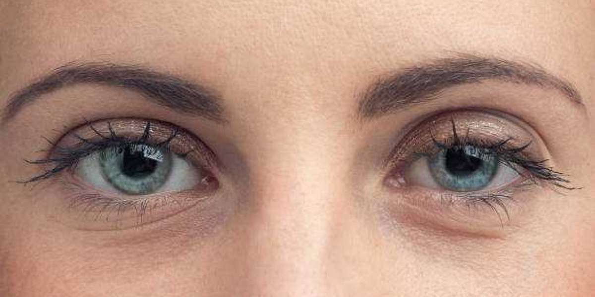 Eyelid Surgery to Restore Eye Beauty and Freshness
