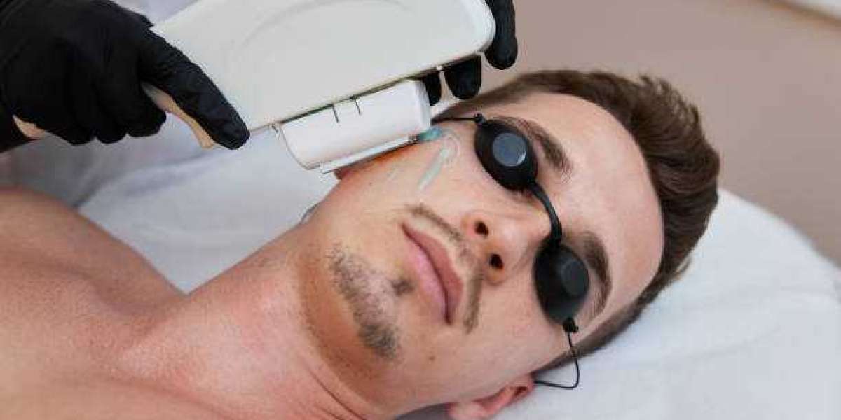 The Ultimate Solution for Smooth Skin with Laser Hair Removal