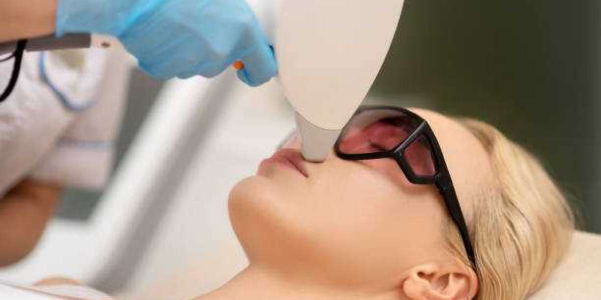 Q-switch Laser Treatment for Healthy Glowing Skin
