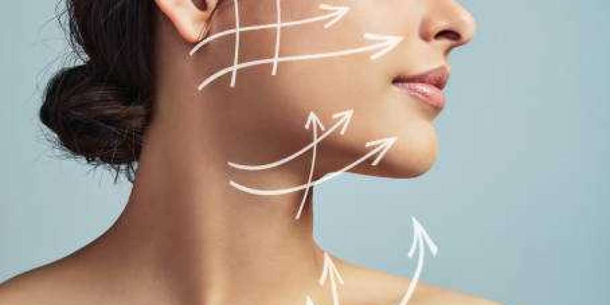 Endolift Treatment for Addressing Mild to Moderate Skin Laxity