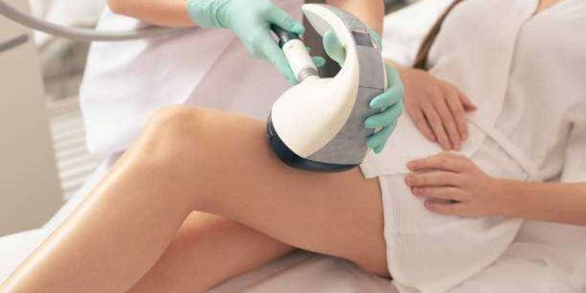Velashape 3 Treatment Explained for Beginners