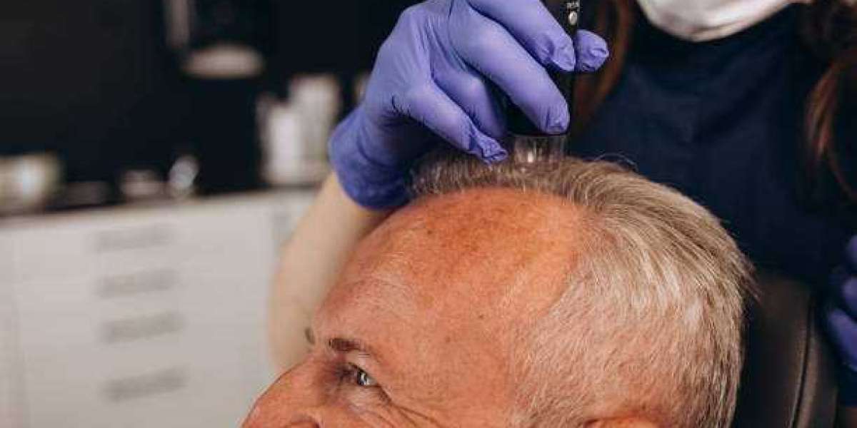 Explore Advanced Exosome Therapy For Hair Loss in Riyadh Solutions