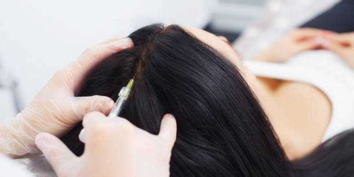 PRP Hair Treatment in Riyadh for Modern Solutions to Hair Thinning