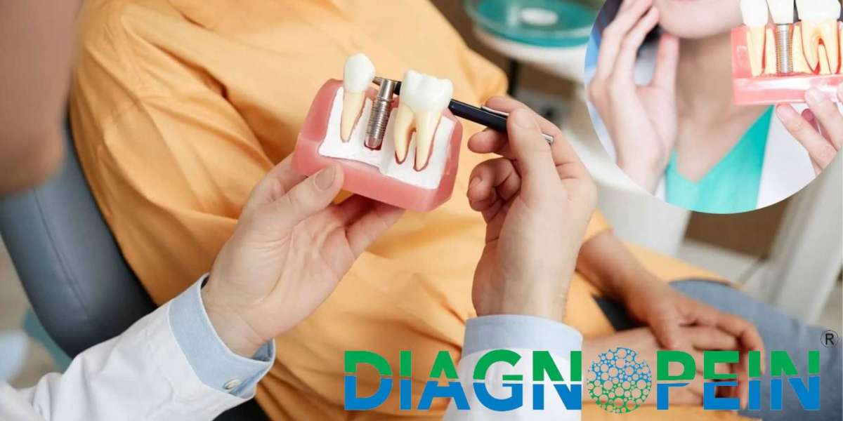 Dental Braces in Pune – Comfortable & Effective Braces Care