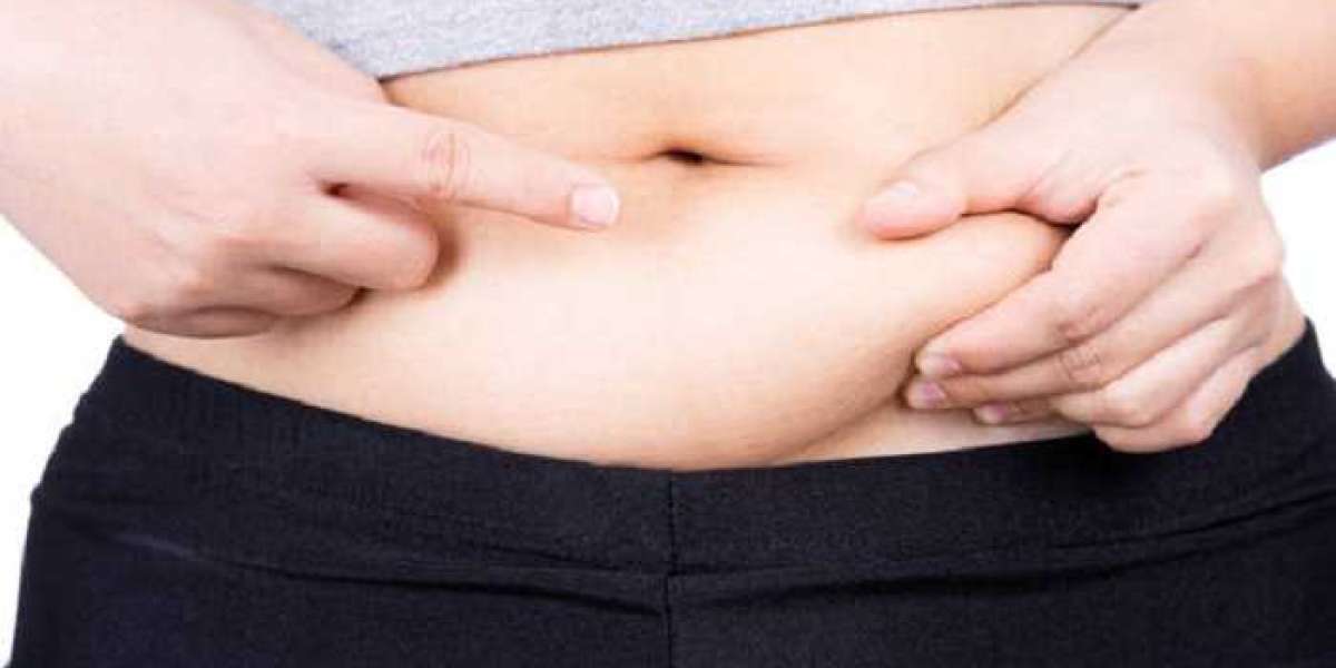 Expert Surgeons Offering Liposuction in Riyadh