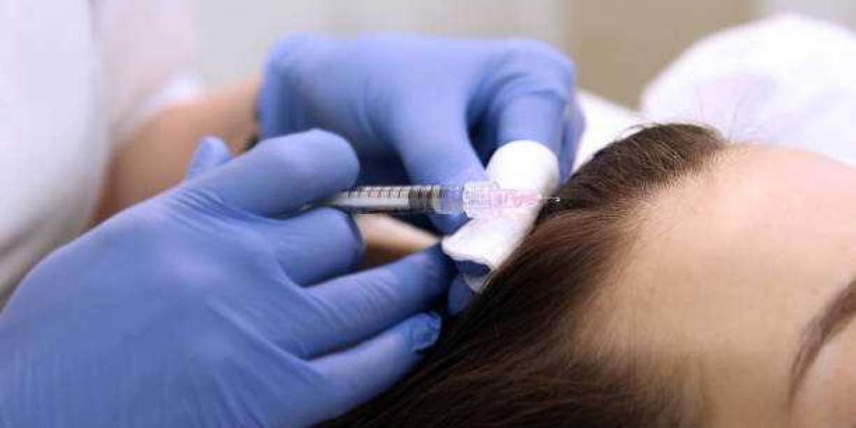 PRP Hair Treatment Benefits for Hair Restoration Goals