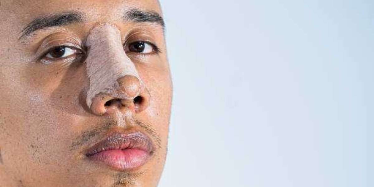 Enhance Your Natural Beauty with Our Riyadh Rhinoplasty Offer
