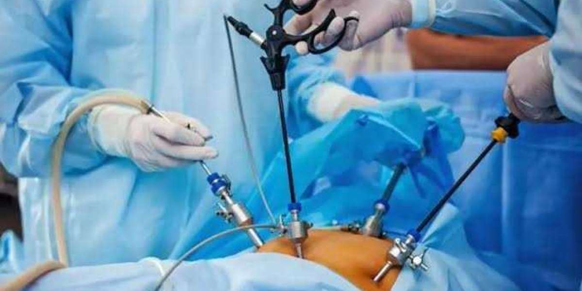 Laparoscopic Surgery in Islamabad: A Complete Guide