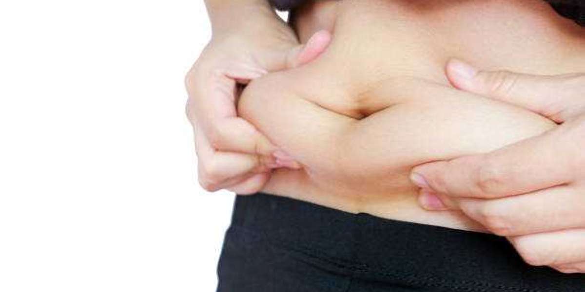 Enhance Your Silhouette with Our Riyadh Tummy Tuck Offer
