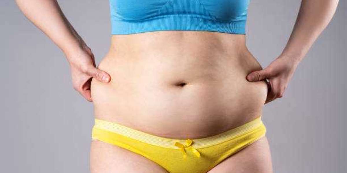 Tummy Tuck Surgery and Its Benefits for Body Reshaping