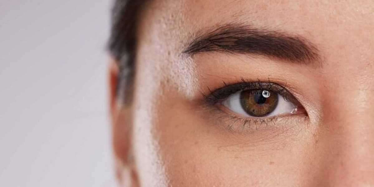Upper Blepharoplasty Dubai: Understanding Eyelid Contouring