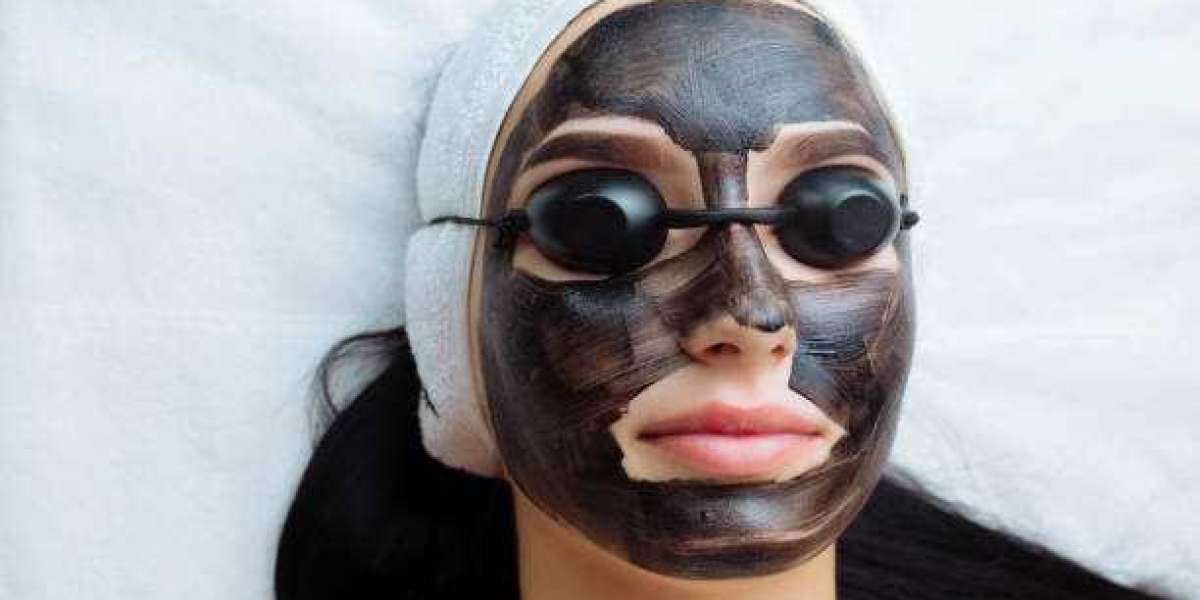 Spectra Laser Carbon Peel for Smoother and More Refined Facial Skin