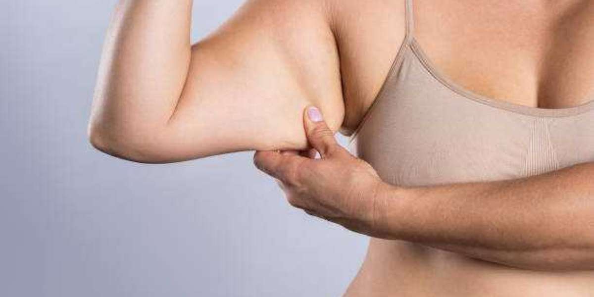 How Arm Lift Surgery Helps Refine the Shape of the Upper Arms