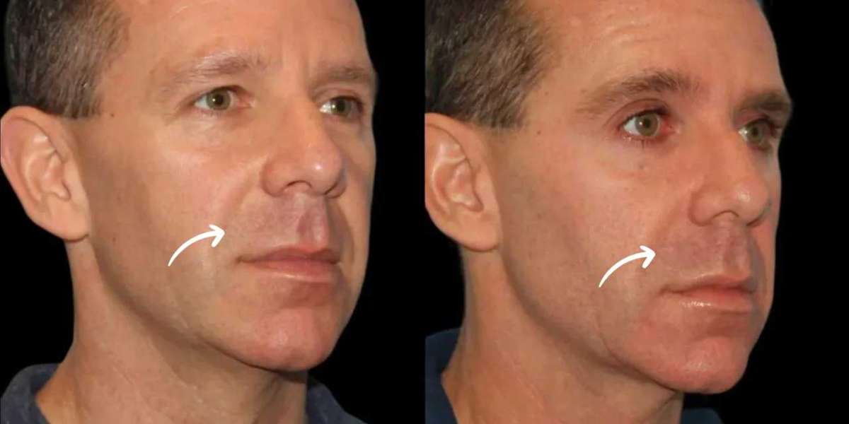 Best Aesthetic Clinics in Dubai for Sculptra Maintenance Scheduling