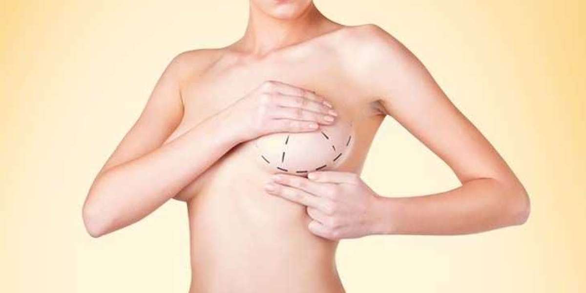How Breast Augmentation in Dubai Complements Body Contouring
