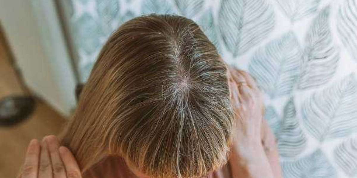 Hair Loss Treatment Guide for Selecting a Suitable Treatment Plan