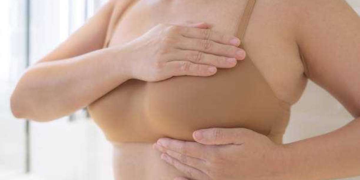 Breast Surgery in Dubai for Patients With Previous Breast Biopsies