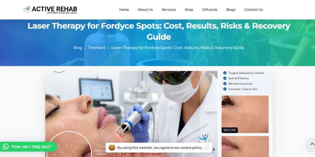 Laser Treatment for Fordyce Spots Cost: What Nobody Tells You Before Booking