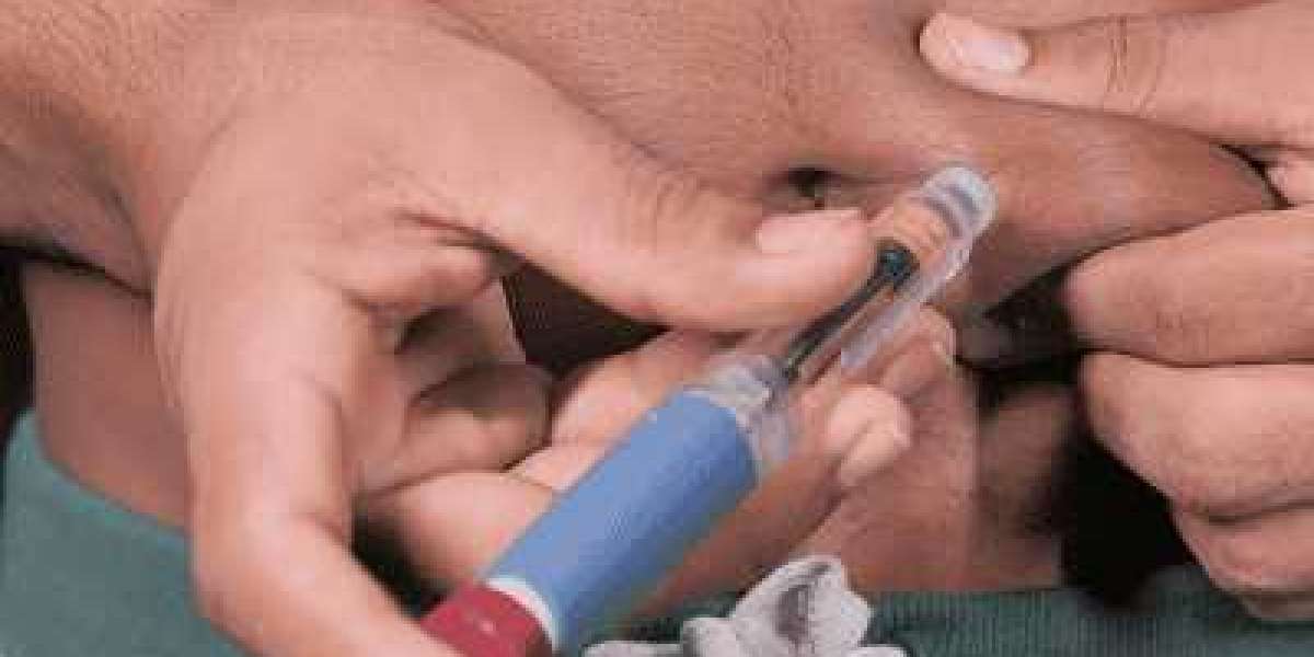 How to Store Mounjaro Injection Correctly