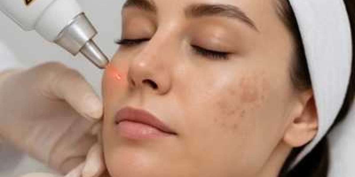 Pigmentation Treatment in Dubai: Restore Even Skin Tone and Natural Radiance