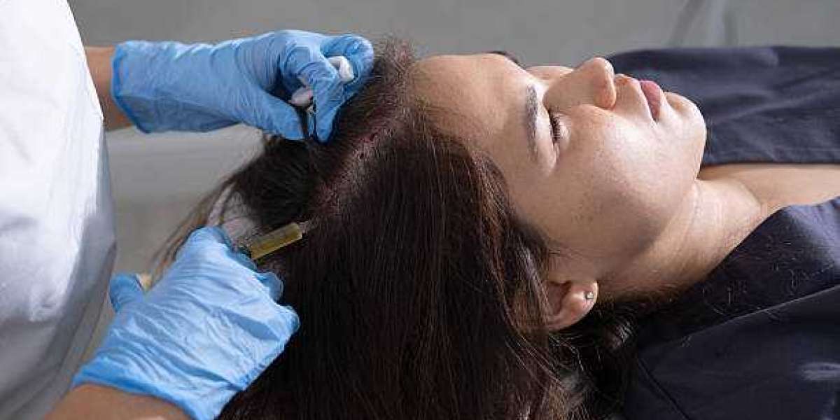 Exosome Hair Therapy in Dubai: A Non-Surgical Hair Restoration Option
